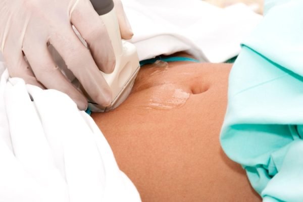ultrasound-6